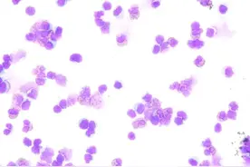 常去菜地玩且爱咬手指……2岁男童被诊断脑内“钻”进寄生虫图片