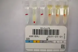 极度罕见的血型！全国仅9人图片