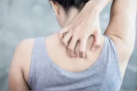 如何精准拍死一只蚊子？图片