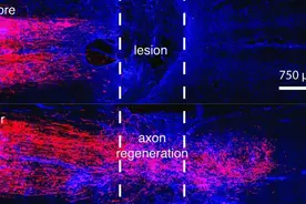 《科学》：重大突破！科学家找到了修复脊髓损伤的关键神经元，并首次证实让此类神经元再生到自然投射区，可逆转瘫痪丨科学大发现图片