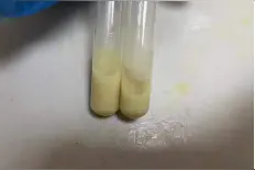 初中生“感冒”持续十多天，确诊为化脓性脑膜脑炎图片