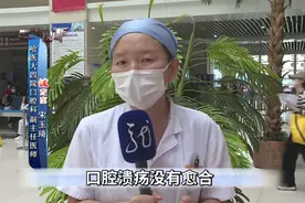 口腔溃疡就是缺维生素吗？听听医生怎么说图片