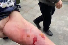 成都一女子小区电梯内被狗咬伤，有业主称伤人犬只疑为禁养犬种马犬，警方称后续将发通报图片