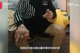 95后小伙双手变形如“生姜”！他的这个习惯很多人都有图片
