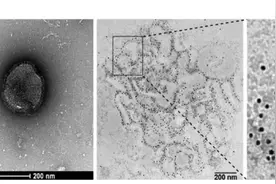 HMPV来袭，普遍易感！发热警惕图片