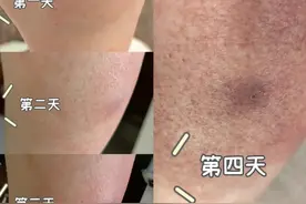 红火蚁进入活跃期，已入侵12个省份，有致命危险！紧急提醒图片