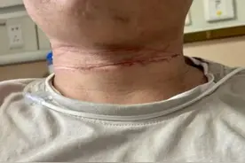 25cm血痕！@外卖小哥 路上做好这些事，保命！图片