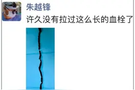 以为是腿痛，结果是血栓!老年人出现这些症状，千万别大意!图片