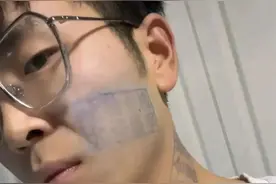 男子输掉游戏脸上被盖猪肉印章，两天洗不掉…图片