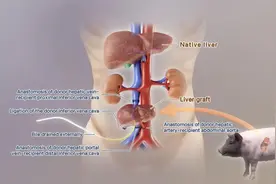 全球首例！基因编辑猪肝脏，被移植到人体图片