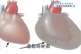 10岁男童被这种虫钻进心脏，画面惊悚！只因3年前一个举动……图片