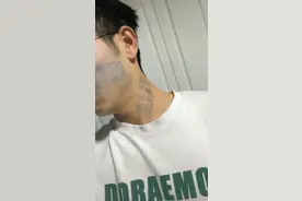 小伙脸盖“猪肉印章”洗不掉 业内人士：猪肉章很特殊，但人体能新陈代谢掉｜封面深镜图片