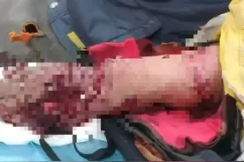 老虎扑咬 73 岁老人撞到铁栅栏，家属：老虎咬人后欲闯我家图片