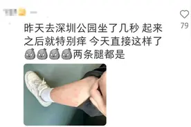 已到高发期！青岛也有人中招，不少人晒出照片：痒到崩溃……图片