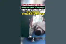 放学路上被狗咬伤男童已出ICU：肇事狗是养了3年的阿拉斯加，主人已赔2万元图片