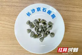 女子患结石仅靠输液缓解疼痛 哪知胆囊结石长成25颗“青梅”图片