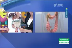 9岁男童每日大便失禁 元凶竟是“便秘”图片