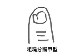 小脚趾甲分两瓣的，是纯种汉族血统？真相来了！图片