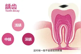 科普视频 | 牙痛揭秘：原来牙痛有这么多种原因！图片