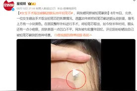 杭州8岁男孩一不小心把铅笔芯扎进……网友：我也有过！图片