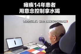 全球首例，首度公开！事关脑机接口图片