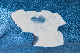 科普｜瘢痕退退退！收好这篇皮肤瘢痕消除攻略图片