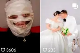 新娘婚礼当天险被毁容！这种东西要慎用图片