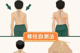 关注脊柱侧弯，守护青少年健康！图片