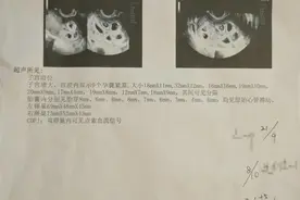 热闻|女子怀上九胞胎，丈夫回应：医生强调必须减胎，可能进行多次手术图片