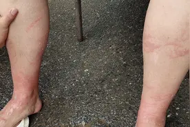 看到立即远离！去海边玩，小心这些“漂亮刺客”图片