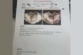 口服避孕药后出血10天是避孕成功的标志吗？需要治疗吗？图片