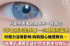江西7岁女孩天生异瞳受到同学喜爱，医生：出现这些情况应及时治疗图片
