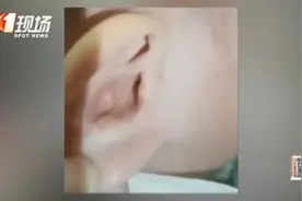 揪心！1岁半宝宝“脑脊液”从耳朵流出，只因模仿大人做了这个动作图片