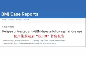 2年3次急性肾损伤！医生建议将染发剂“拉黑”！很多人常用图片