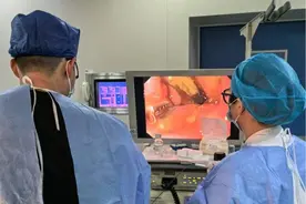 “超微创”手术，不开刀也能治疗阑尾炎图片