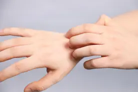 孩子多汗，5个特征区分生理性或病理性图片