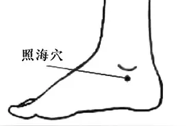 你以为的“上火”，其实是这些病图片