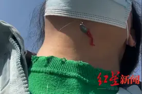 女子在北京亮马河边散步被钓鱼大爷甩钩刺脖 律师称系意外事件但需承担民事赔偿责任图片