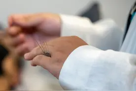 记者观察：中医架起民心相通桥 合作谱写杏林新佳话图片