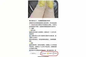 生姜捣碎敷膝盖=简易版三伏贴？功效有差距，皮肤易过敏者慎用|网红说法求真图片