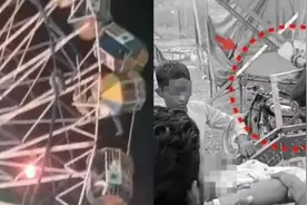 恐怖瞬间，印度13岁女孩头皮被瞬间扯掉当场昏迷，小心这项娱乐设施…….图片