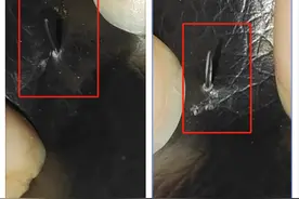 男子骑共享电单车被车座上暗针所伤，律师：若找不到实施者，运营商需承担赔偿责任图片