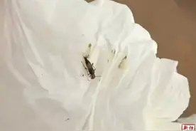 紧急提醒：这种虫子不要拍打！黑龙江一男子腿部已溃烂……图片