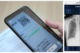 拍片不用等取片？市一医院白云医院“云胶片”秒查报告图片