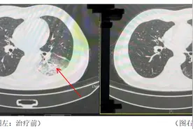 空调久未清洗 专家提醒吹前必查→图片