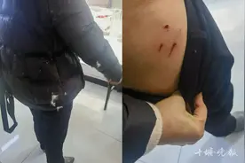 它8天伤3人！十堰警方仍在调解图片