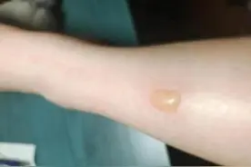 气温降低，使用取暖“神器”要注意→图片