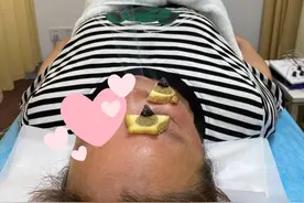 命都是空调给的？病也是！高温贪凉睡眠不足，年轻大学生急性“面瘫”图片