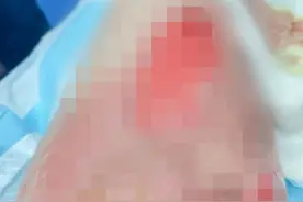 女子乘飞机被邻座碰倒热茶致大腿二级烫伤，航司否认存过错拒绝赔偿，阿联酋航空回应图片