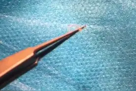 一岁宝宝眼中惊现活虫 医生提醒：宠物需定期驱虫图片